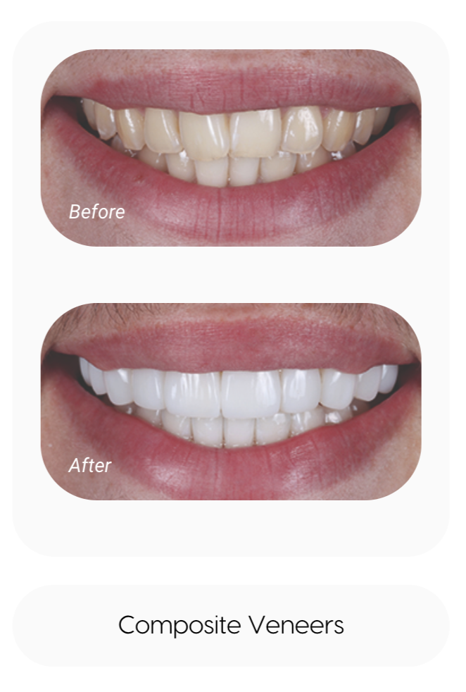 sameday smile - VCDP - Cannock 2