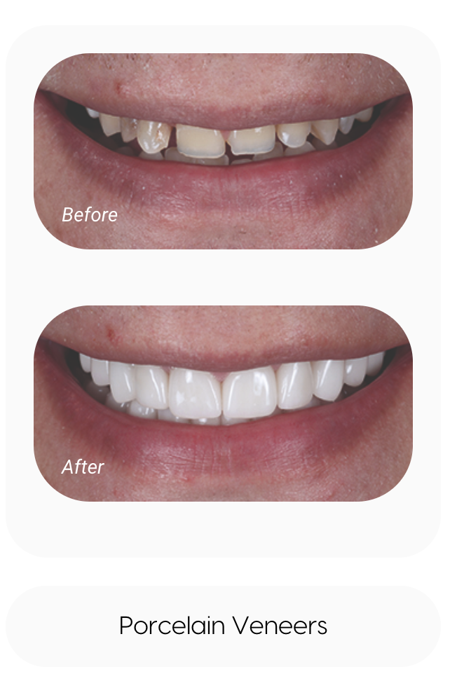 sameday smile - VCDP - Cannock 3