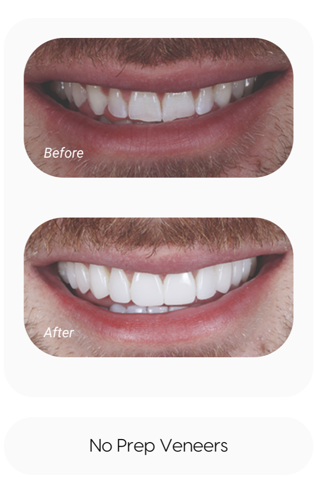 sameday smile - VCDP - Cannock 4