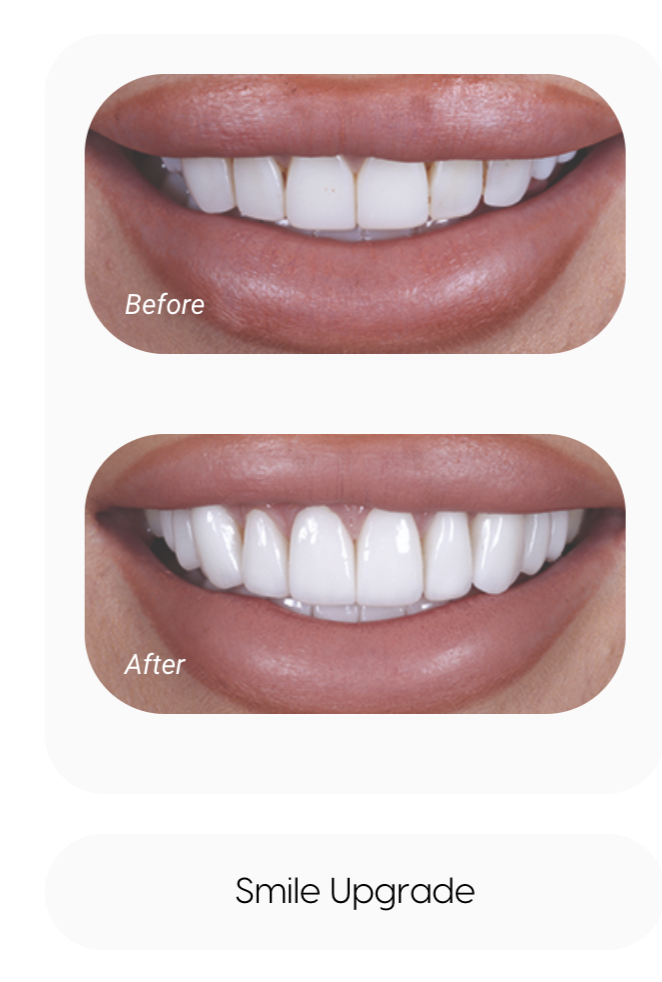 sameday smile - VCDP - Cannock