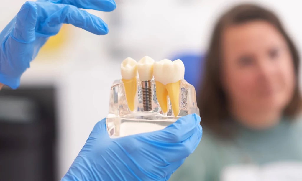 Dental Implants in Cannock: Cost & Process